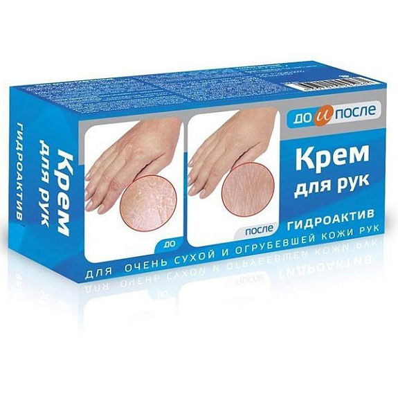 Крем для сухой кожи рук гидроактив До и После, 100 мл