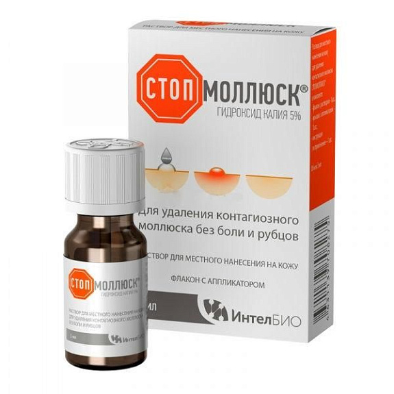 Стопмоллюск для удаления контагиозного моллюска без боли и рубца, 5 мл