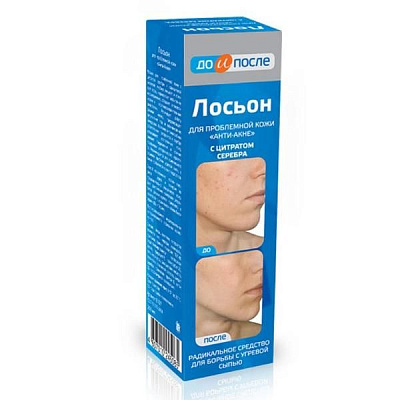 Лосьон для проблемной кожи анти-акне До и После, 200 мл