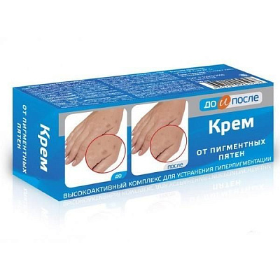 Крем от пигментных пятен До и После, 50 мл