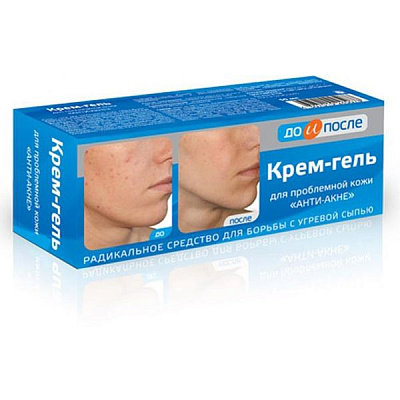 Крем-гель для проблемной кожи анти-акне До и После, 50 мл